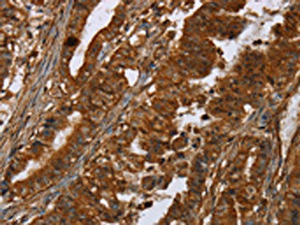POU6F2 Antibody (PACO20265)