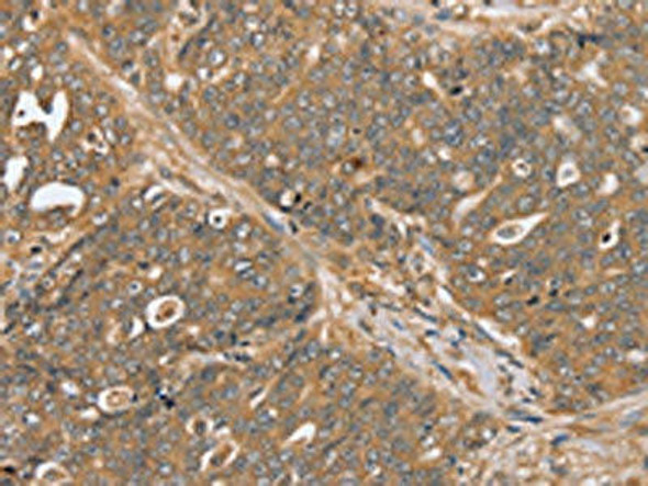 PTPN20A Antibody (PACO20293)