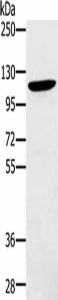ZMIZ1 Antibody (PACO20336)