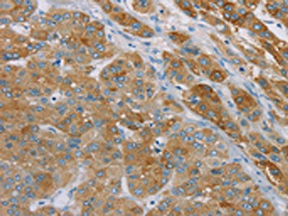 SAMD4A Antibody (PACO20384)