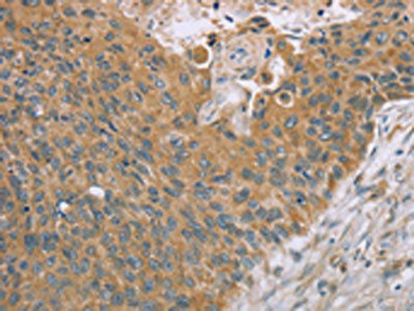 SAMD4B Antibody (PACO20387)