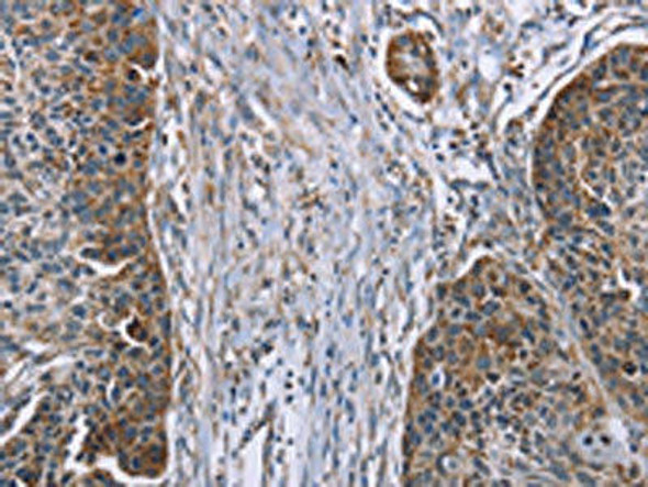 IQCJ Antibody (PACO20402)