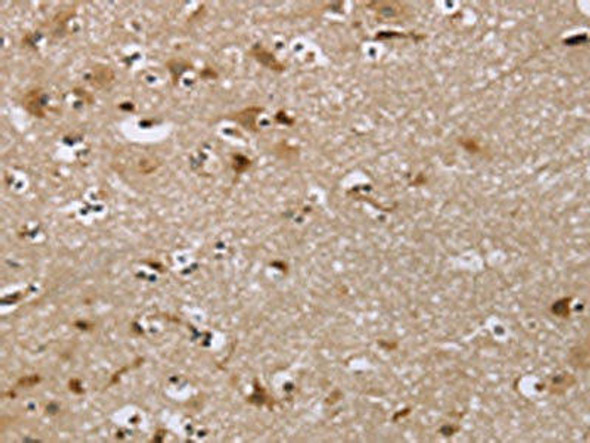 IQCJ Antibody (PACO20403)