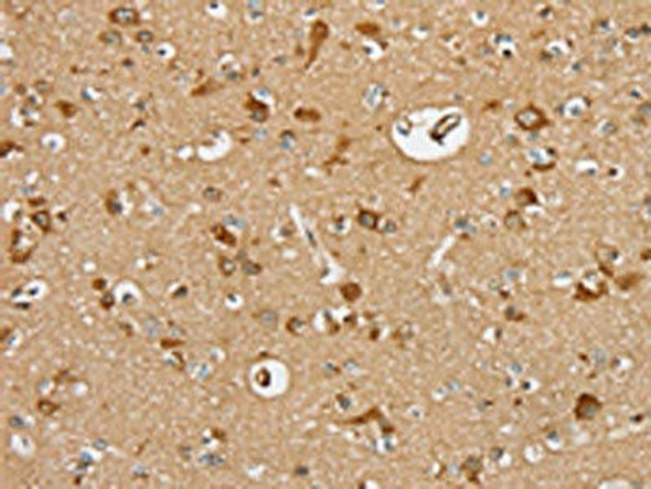 SERINC2 Antibody (PACO20437)