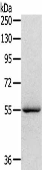 SERINC4 Antibody (PACO20442)