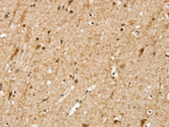 SRP68 Antibody (PACO20468)
