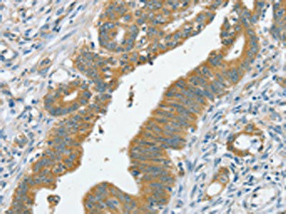 SLC39A3 Antibody (PACO20504)