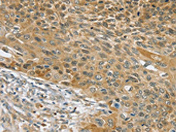 SLC39A3 Antibody (PACO20505)