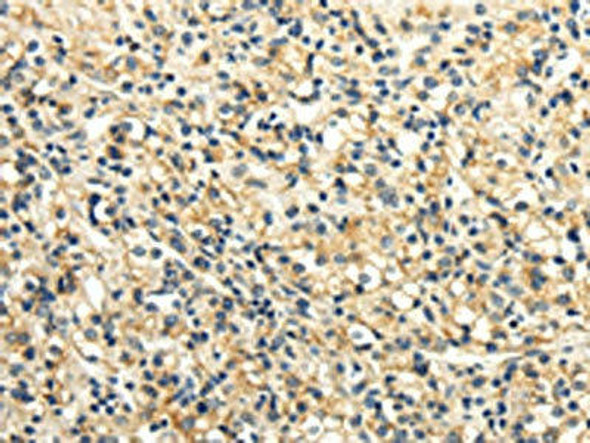SLC6A19 Antibody (PACO20524)