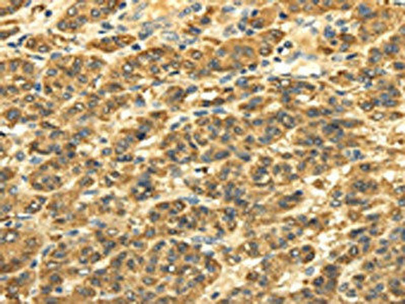SLC6A19 Antibody (PACO20525)