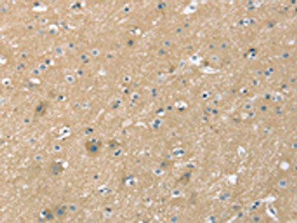 SMAGP Antibody (PACO20549)