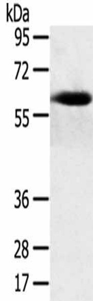 SPATA18 Antibody (PACO20591)