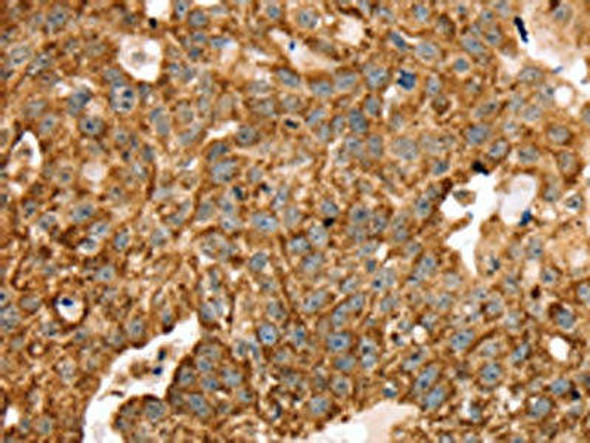 STK32B Antibody (PACO20618)