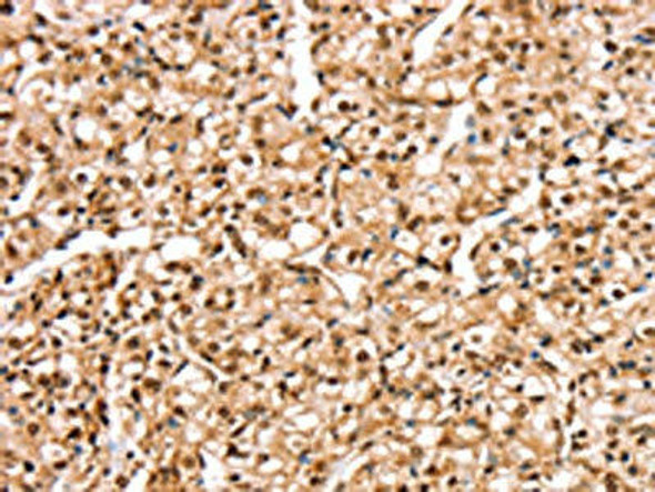 STK32B Antibody (PACO20619)