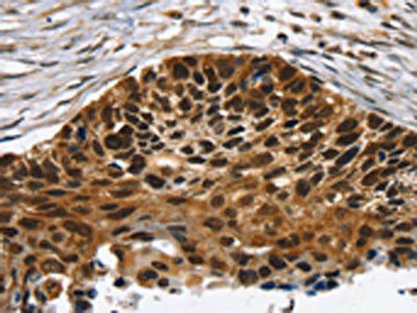 TACC2 Antibody (PACO20648)