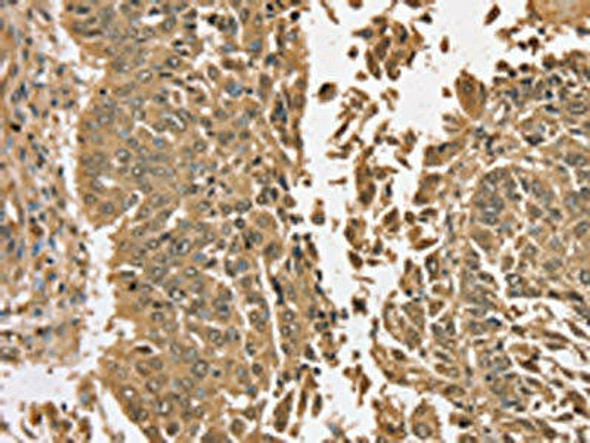 TGM6 Antibody (PACO20749)