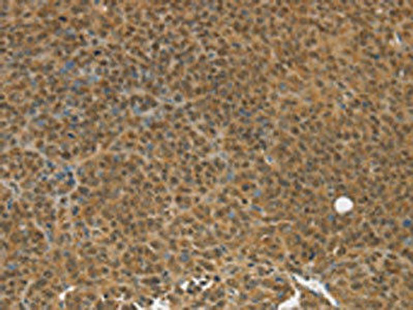 TGM7 Antibody (PACO20750)
