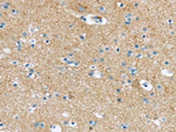 VAMP1 Antibody (PACO20847)