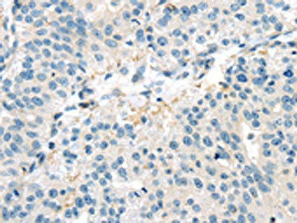 VAV2 Antibody (PACO20851)