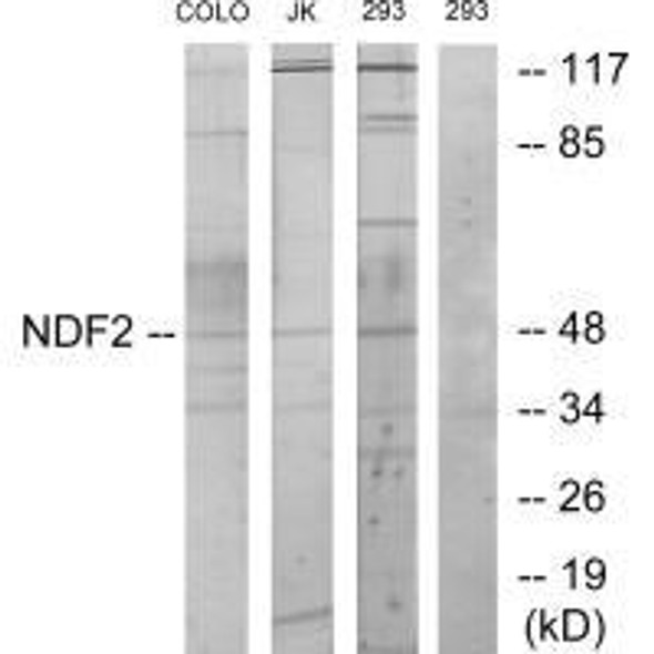 NEUROD2 Antibody (PACO21862)