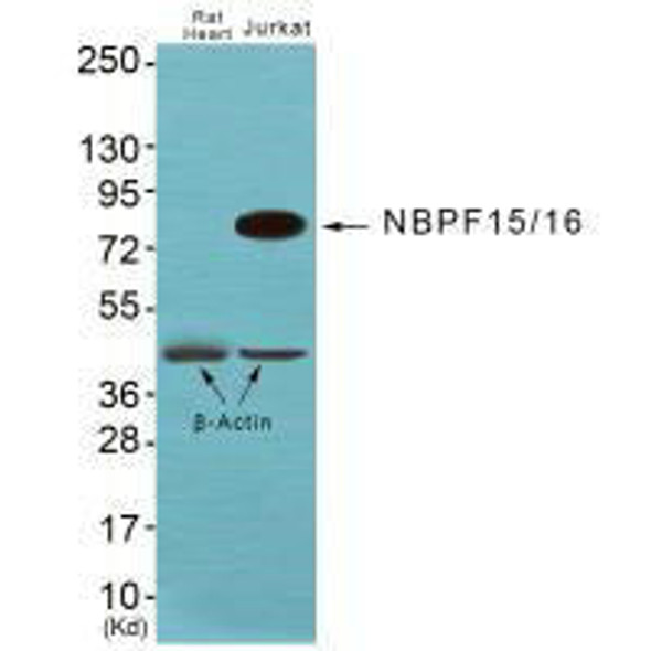 NBPF1/NBPF9/NBPF10/NBPF12/NBPF14/NBPF15/NBPF16/NBPF20 Antibody (PACO22462)