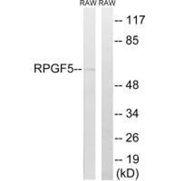 RAPGEF5 Antibody (PACO22545)