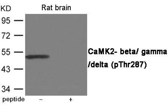 Phospho-CAMK2B/CAMK2G/CAMK2D (Thr287) Antibody (PACO23981)