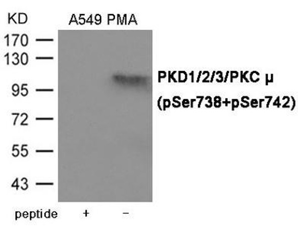 Phospho-PRKD1/PRKD2/PRKD3 (Ser738/742) Antibody (PACO23993)