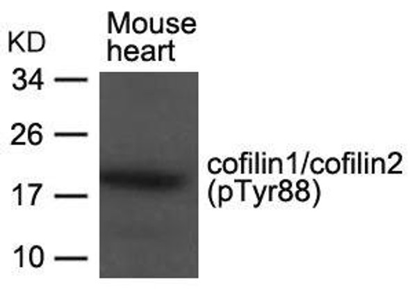 Phospho-CFL1/CFL2 (Tyr88) Antibody (PACO24337)