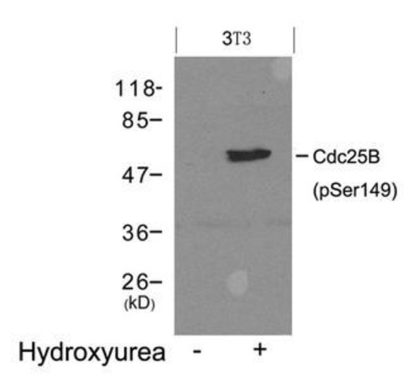 Phospho-Cdc25b (Ser149) Antibody (PACO24346)