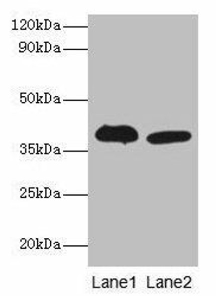Adh5 Antibody (PACO24775)