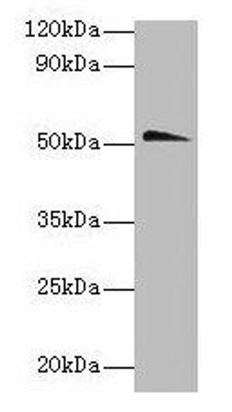 Chrna1 Antibody (PACO25757)