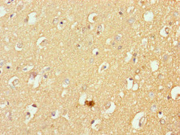 MFSD11 Antibody (PACO28230)