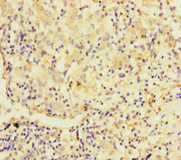 TMPRSS11B Antibody (PACO37358)