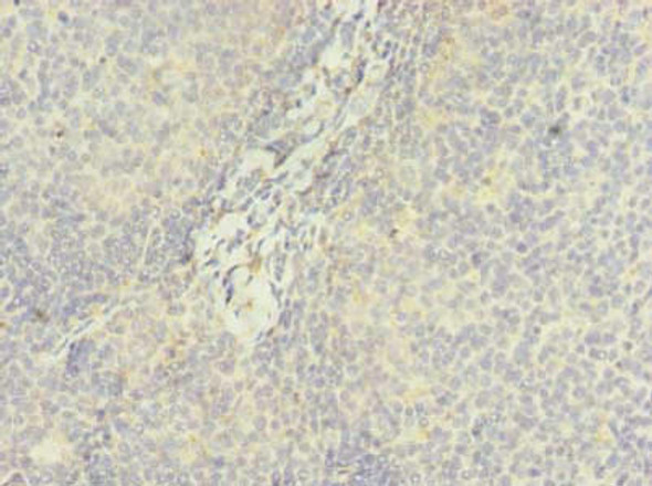DDX42 Antibody (PACO37422)