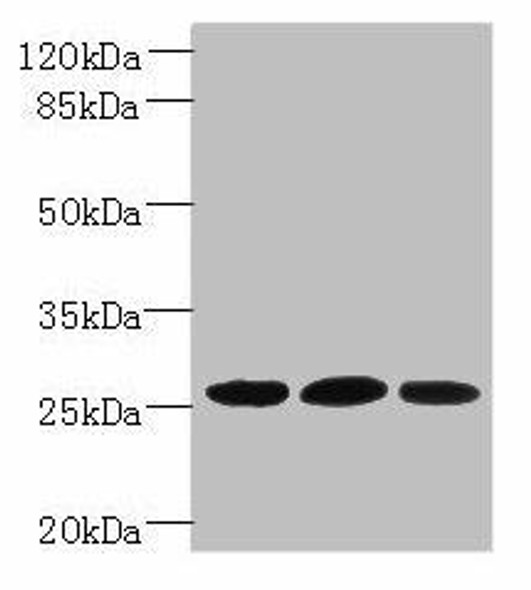 Plet1 Antibody (PACO39738)