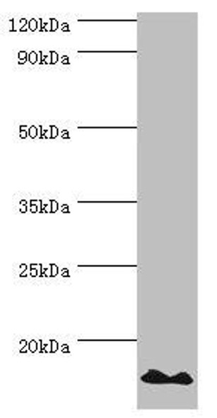 POLR1D Antibody (PACO43636)