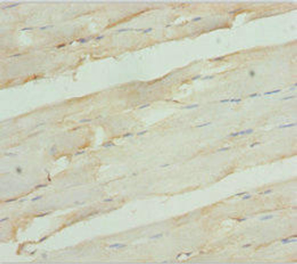 RDH12 Antibody (PACO44971)