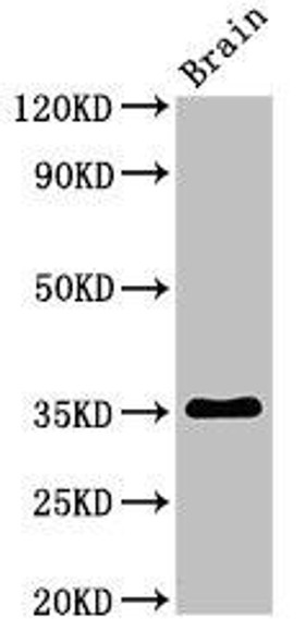 Metrnl Antibody (PACO52702)