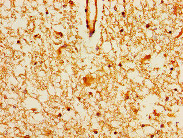 MAGI2 Antibody (PACO55198)