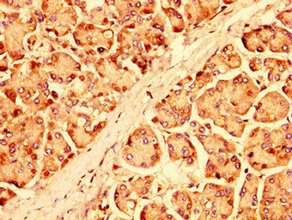 UBR1 Antibody (PACO56414)