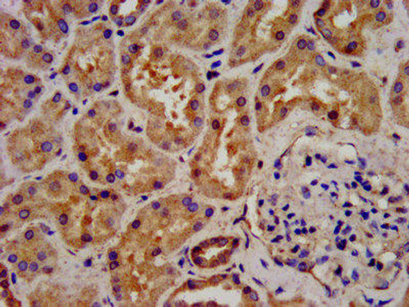 ATAT1 Antibody (PACO57200)