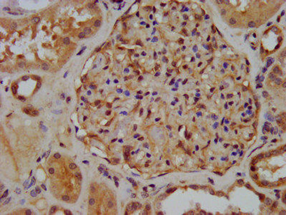 XIRP2 Antibody (PACO58044)
