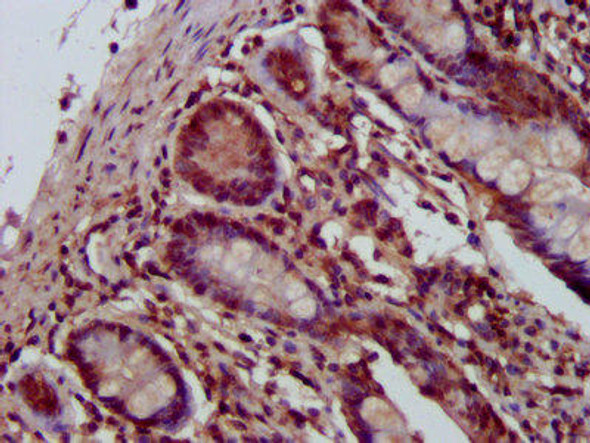 SHPRH Antibody (PACO58144)