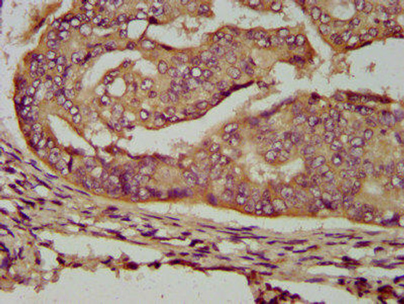 ENOSF1 Antibody (PACO58204)