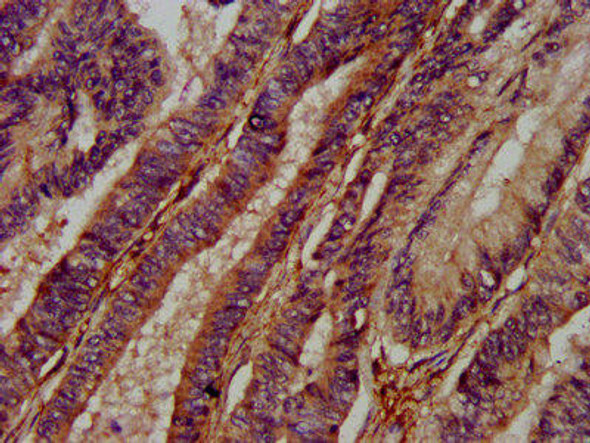 ADAMTS15 Antibody (PACO58328)