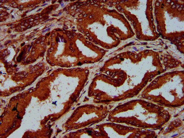 ELP4 Antibody (PACO59337)