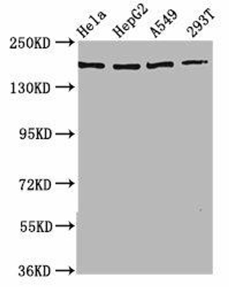 HECW2 Antibody (PACO59525)