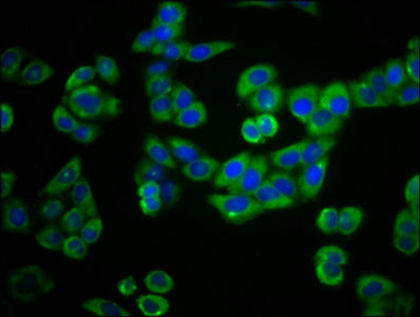 PLEKHG5 Antibody (PACO59844)