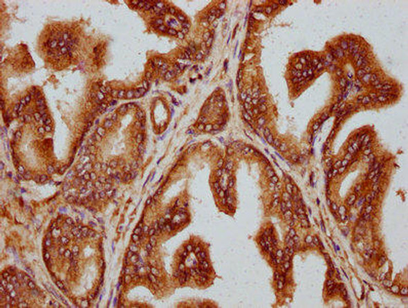 TTLL3 Antibody (PACO59960)